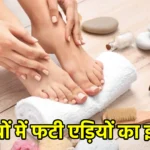 सर्दियों में फटी एड़ियों का इलाज: प्राकृतिक उपाय