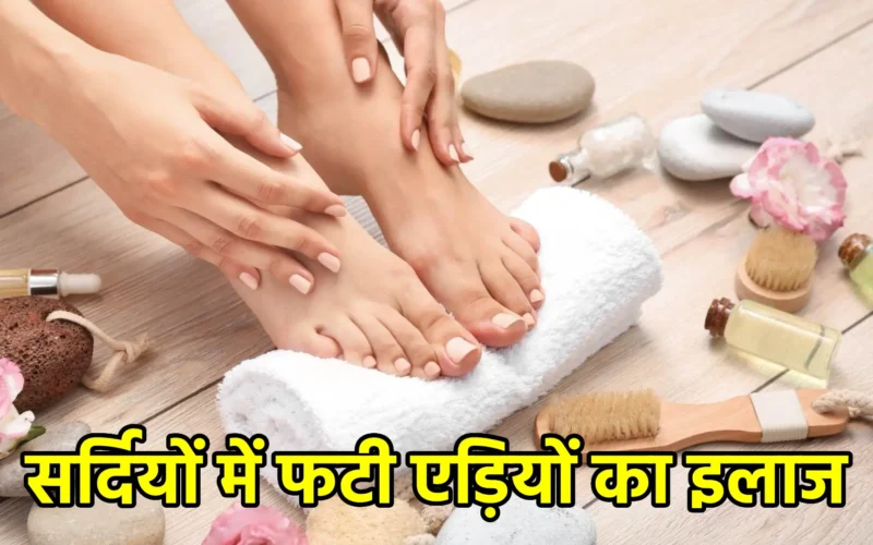 सर्दियों में फटी एड़ियों का इलाज: प्राकृतिक उपाय